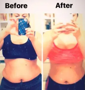 img.before-after-4