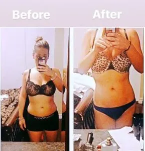 img.before-after-5